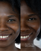 Side-by-side comparison of a woman's smile with and without foundation, labeled 'The Golden Touch Foundation UNSTOPPABLE'.